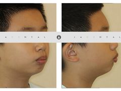 -齐玉齿科JADENTAL