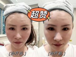 -圣嘉新医疗美容医院