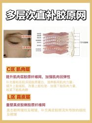 -克丽缇娜