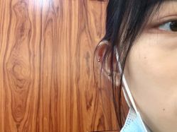 -伊丽莎白医疗美容