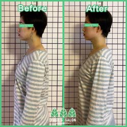 -FACE·日本小颜矫正美容整骨サロン