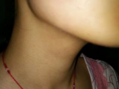 -东南大学附属中大医院(本部)