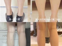 -上海仁爱医院