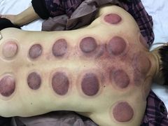 -安琪盲人按摩调理草本熏蒸馆(风和日丽店)