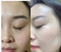 点击看大图 -SKIN79皮肤管理中心