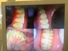 -赫尔森口腔·牙齿种植修复