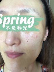 体验后-坤如玛丽·医疗美容中心