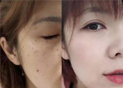 -慈蕊美容养生·专业经络调理