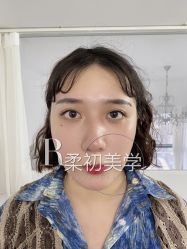 -RC半永久纹眉纹发际线