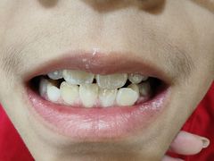 -佛山中大口腔医院·市二级口腔专科医院