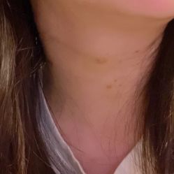 体验后-北京米扬丽格医疗美容·联合丽格鼻整形中心