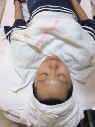 -苗方清颜专业祛痘