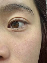 点击看大图 -MLP美丽派·问题肌疗愈中心