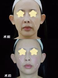 -Yestar重庆艺星医疗美容医院
