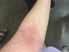 -龙达温泉生态城