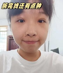 -素美医疗美容·西南眼鼻整形·修复基地