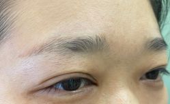 点击看大图 体验前-重庆联合丽格第五医疗美容医院
