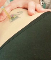 点击看大图 -北京米扬丽格医疗美容·联合丽格鼻整形中心