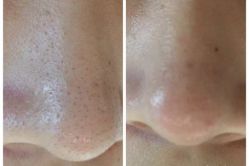 点击看大图 -MedSkinCare科技祛痘肌肤修护中心