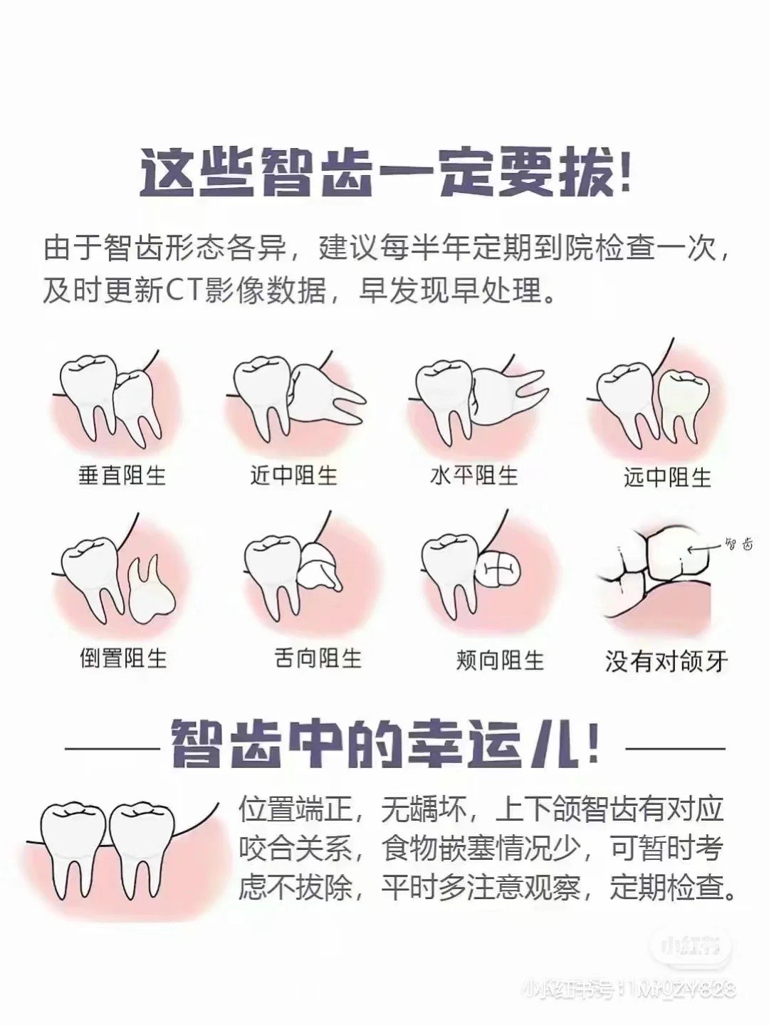 上牙智齿位置图图片