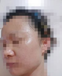 体验前-比华利美容医院