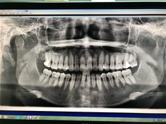 -天使口腔门诊部(上海店)