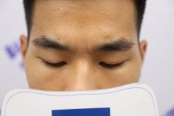 -大麦微针植发丨全国连锁