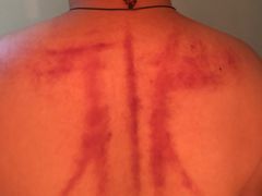 -长赢养生(平度店)