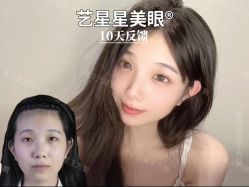 -Yestar重庆艺星医疗美容医院