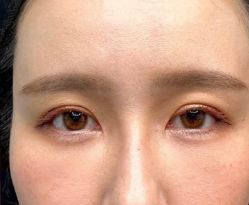 -天津健丽·去眼袋医疗美容机构
