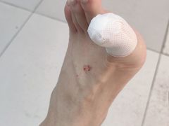 -新甲连锁灰指甲·甲沟炎·鸡眼(黑龙江路店)