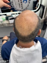 -唐风采假发补发定制