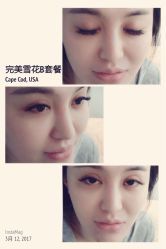 睫毛嫁接-光SPA科技美肤