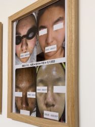 -美肤盾祛痘·问题肌头疗管理中心