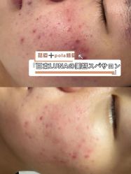 -LUNA皮相美·骨相美高级美感
