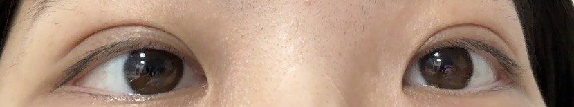 -JustHer宁波珈禾医疗美容医院