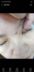 -百年美肤堂祛痦痣祛斑祛疣