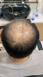 -发饰美男士增发补发假发定制店