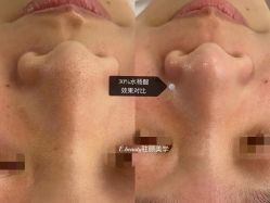 -E.beauty驻颜·痘敏肌调理中心