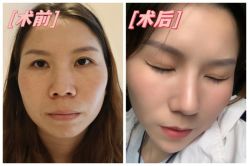 -素美医疗美容·西南眼鼻整形·修复基地