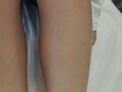 -小梨·OndaPro·专业脱毛连锁机构
