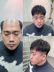 -型男帮男士假发补发·佩戴式发型