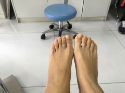 点击看大图 -派恩宜灰指甲·甲沟炎·鸡眼康护