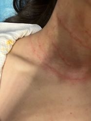 -深圳米兰柏羽医疗美容医院