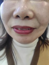 -长沙雅美医疗美容医院