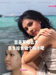 -北京米扬丽格医疗美容·联合丽格鼻整形中心