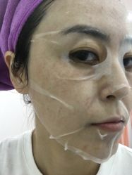 -新美荟医美·专注面部美学抗衰