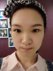 点击看大图 半个月后的效果-依萱绮医疗美容