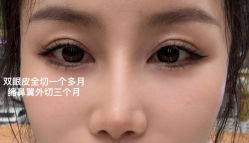 -四川华美紫馨整形外科医院