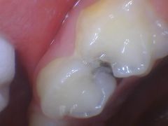 -天使口腔门诊部(上海店)